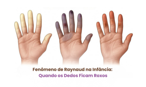 Fenômeno de Raynaud na Infância: Quando os Dedos Ficam Roxos - Dra Ana ...