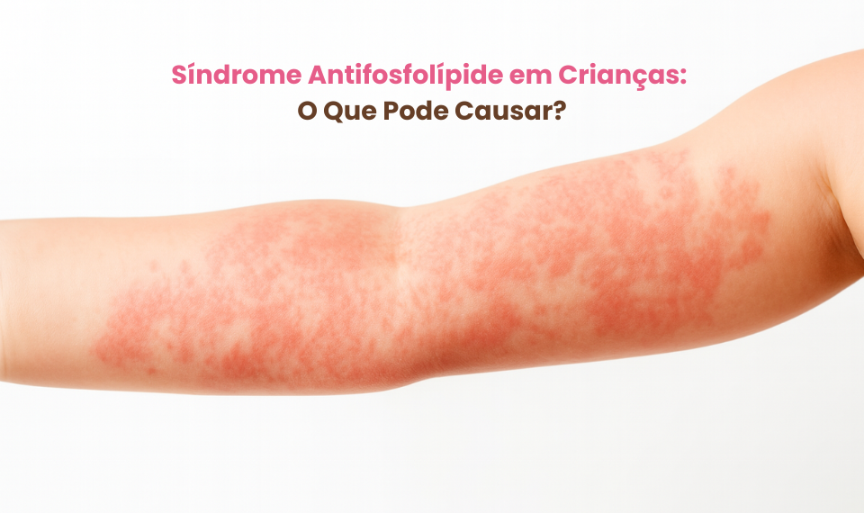 Síndrome Antifosfolípide em Crianças: O Que Pode Causar?